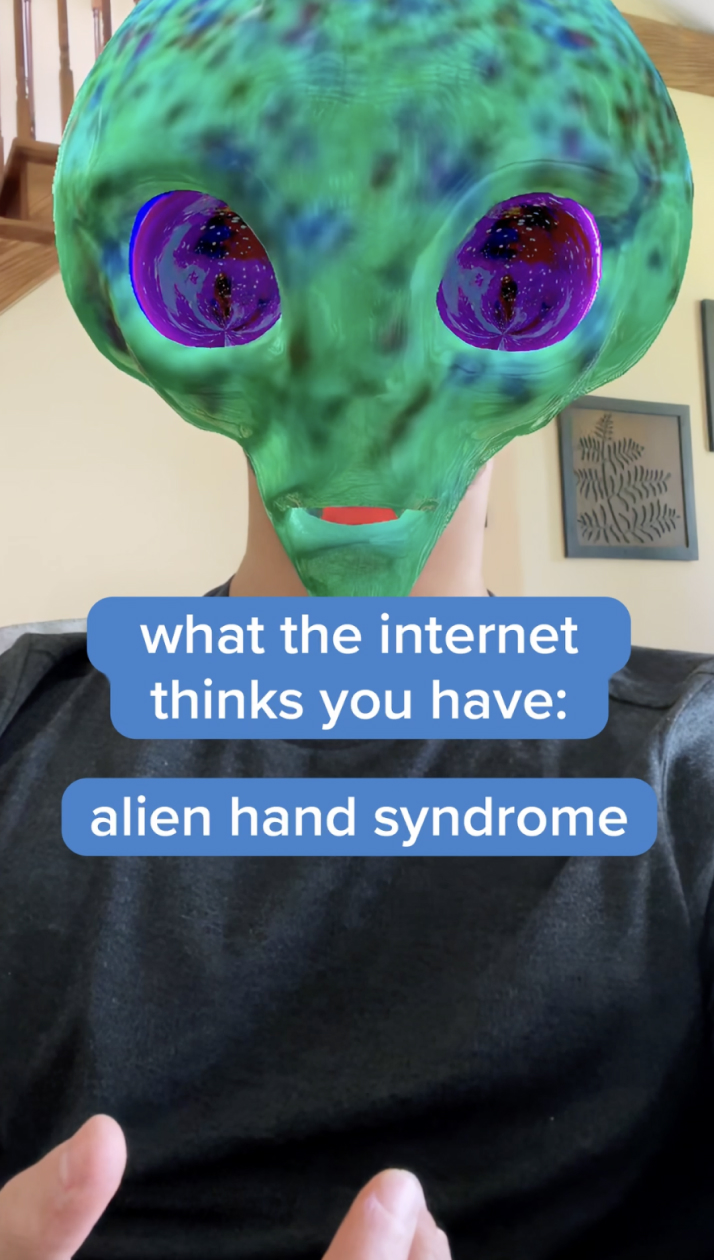 Click to play the "alien hands" video.