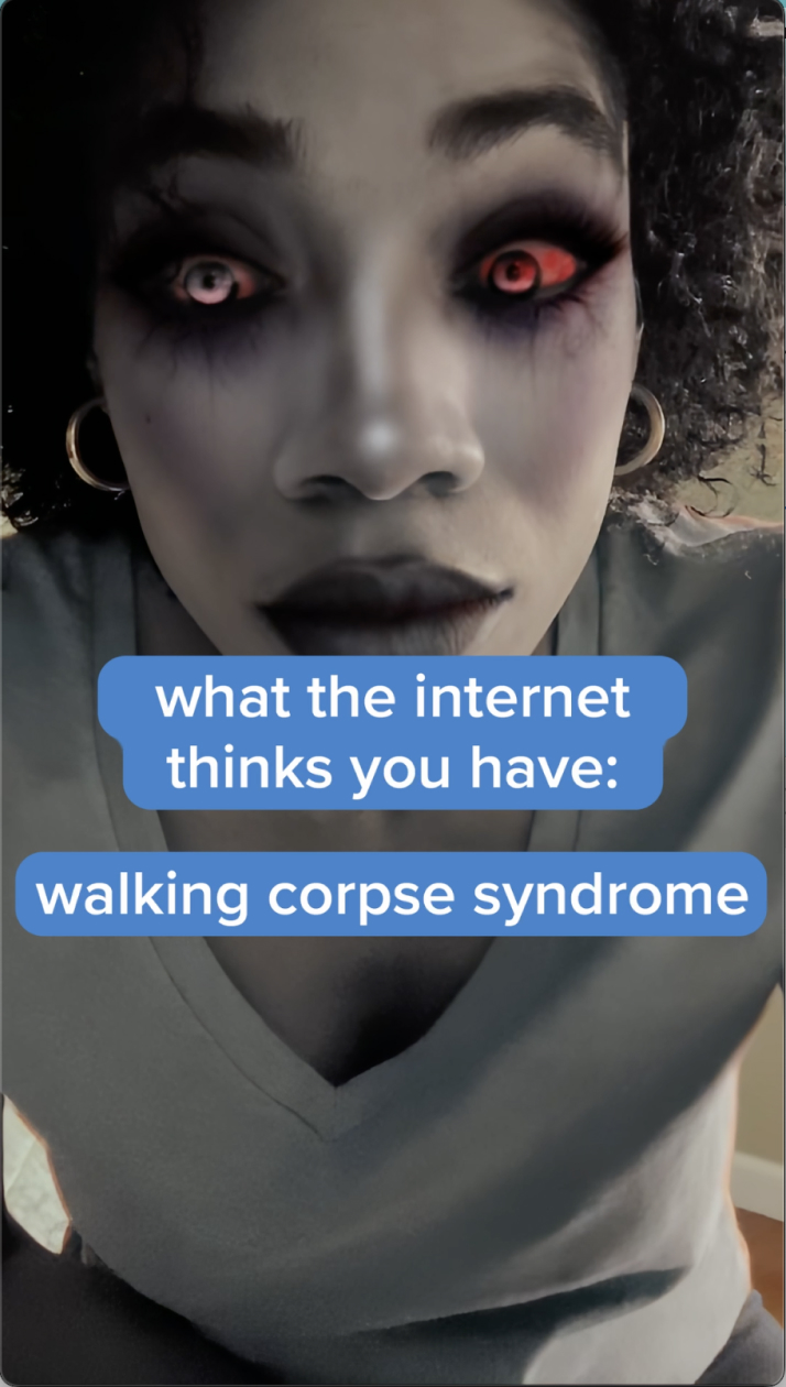 Click to play the "walking corpse" video.